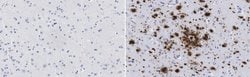 Amyloid beta fibrils Rabbit anti-Human, Mouse, Clone: M87, MilliporeSigma:Antibodies:Primary